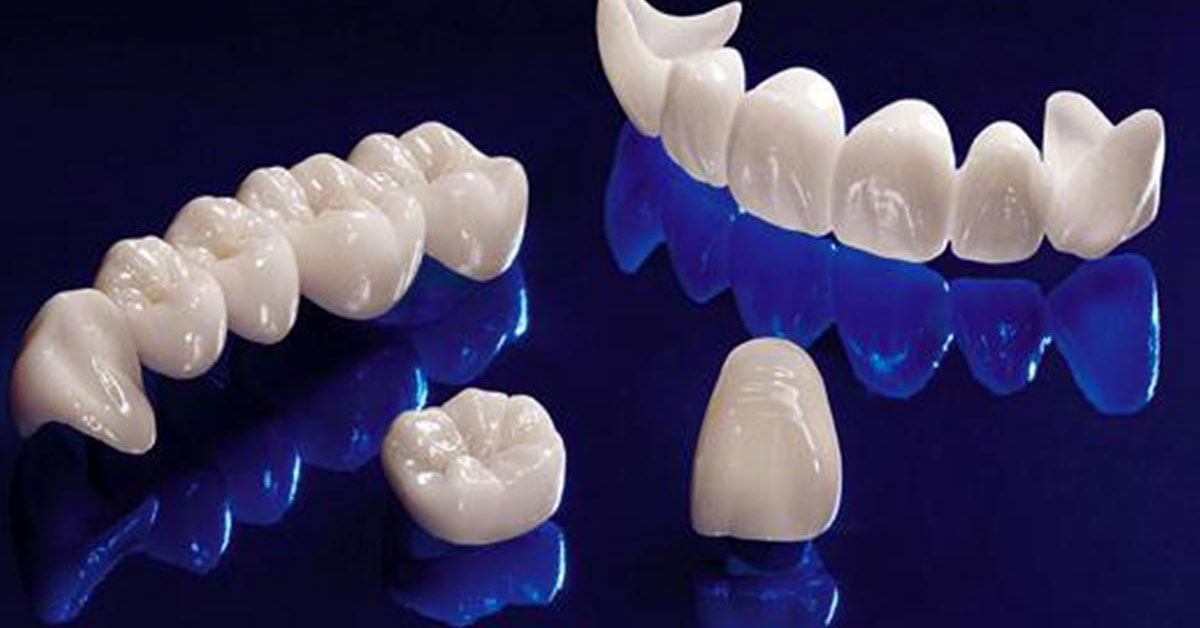 Nha khoa giảm giá răng toàn sứ uy tín chất lượng-03